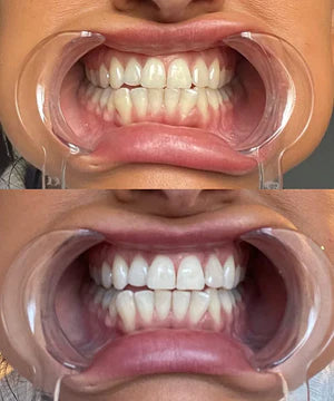 V34 Purple Tooth Whitening Strips