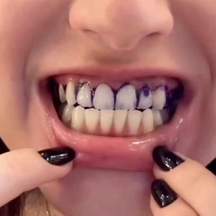 V34 Purple Tooth Whitening Strips